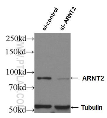Western Blot (WB) analysis of Jurkat cells using ARNT2 Polyclonal antibody (12810-1-AP)