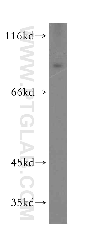 Western Blot (WB) analysis of Jurkat cells using ARNT2 Polyclonal antibody (12810-1-AP)