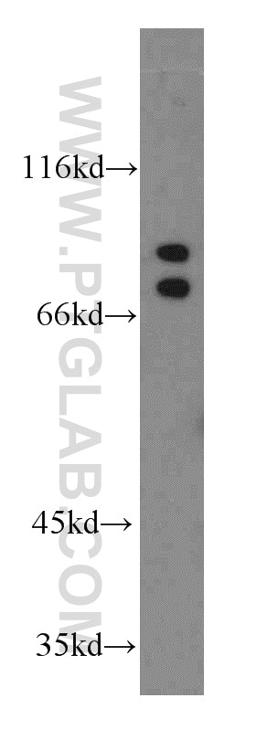 Western Blot (WB) analysis of HEK-293 cells using ARNT2 Polyclonal antibody (12810-1-AP)