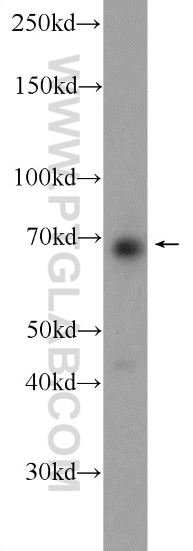 Western Blot (WB) analysis of 3T3-L1 cells using ARNTL Polyclonal antibody (14268-1-AP)