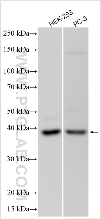 Western Blot (WB) analysis of various lysates using ARPC1A Polyclonal antibody (17538-1-AP)