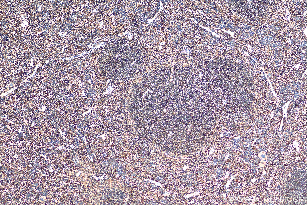 Immunohistochemistry (IHC) staining of mouse spleen tissue using ARPC1B Polyclonal antibody (28368-1-AP)