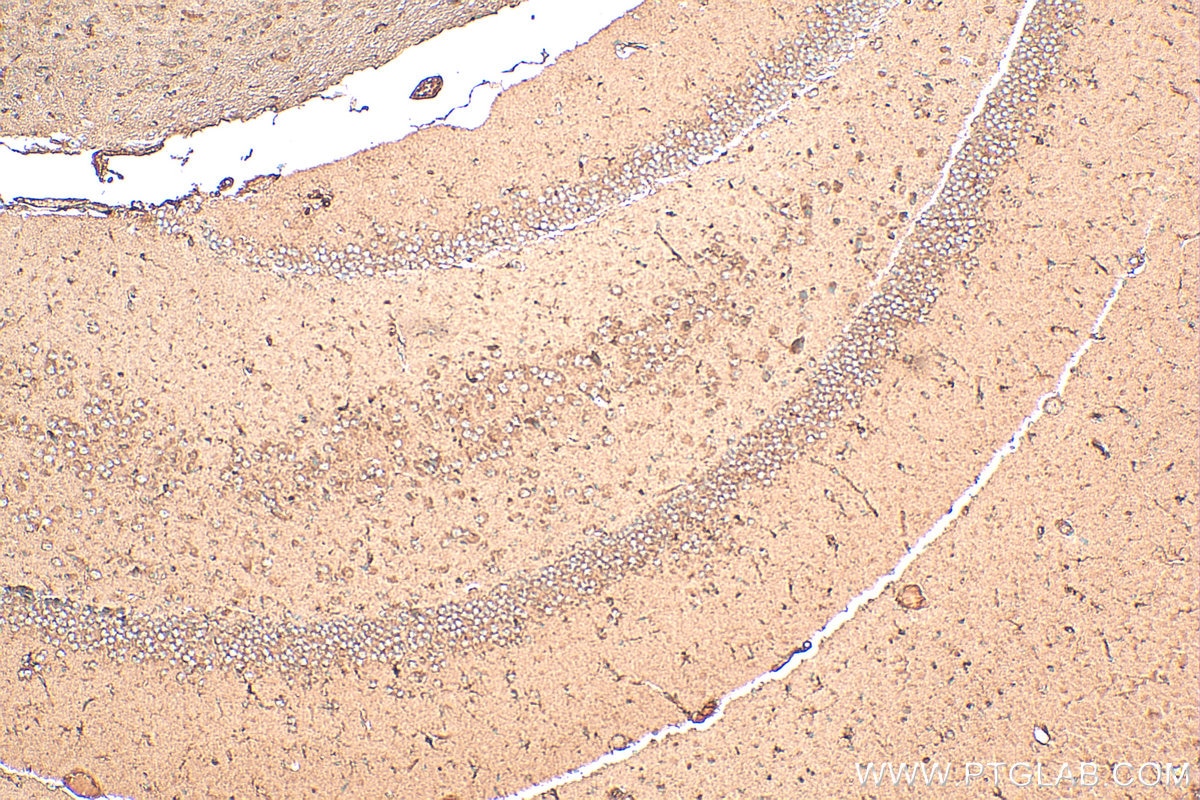 Immunohistochemistry (IHC) staining of mouse brain tissue using ARPC1B Polyclonal antibody (28368-1-AP)