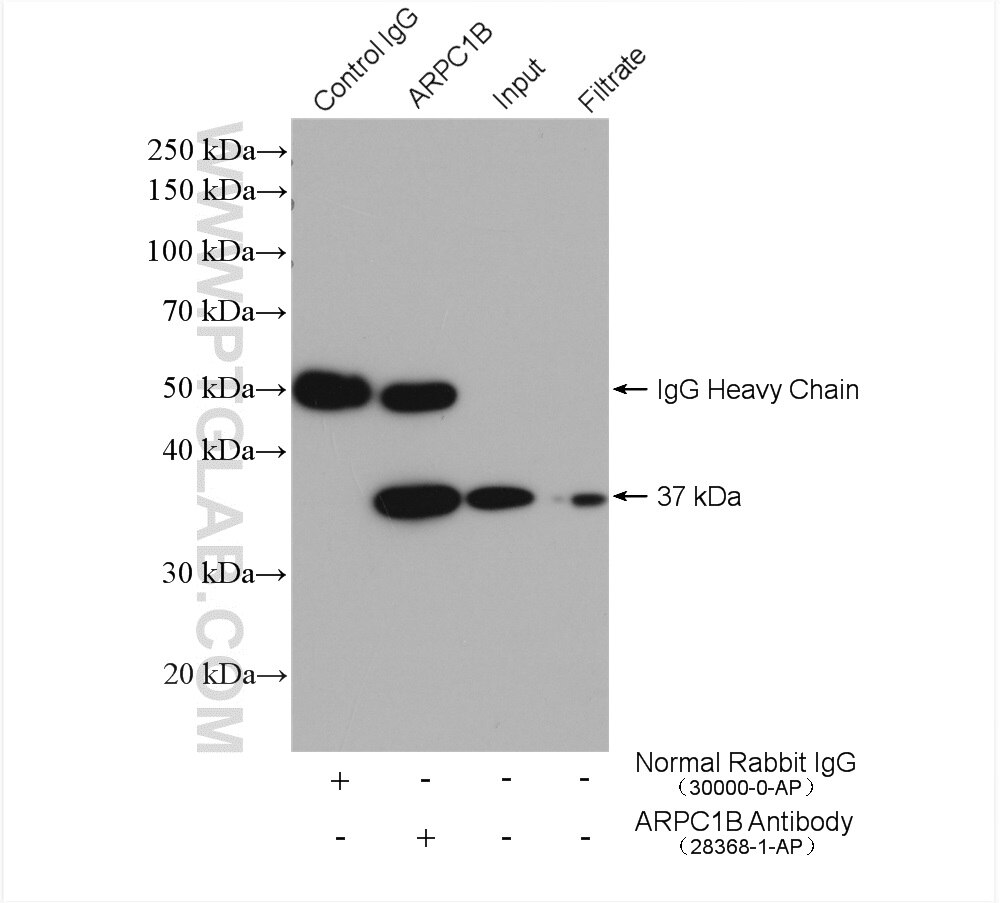 Immunoprecipitation (IP) experiment of HeLa cells using ARPC1B Polyclonal antibody (28368-1-AP)