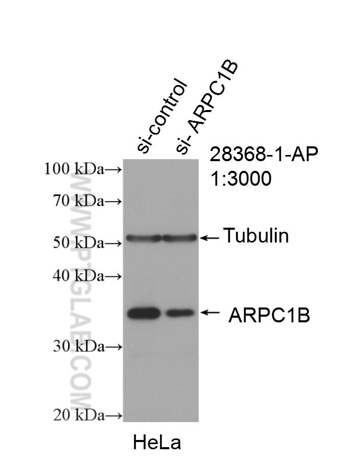 Western Blot (WB) analysis of HeLa cells using ARPC1B Polyclonal antibody (28368-1-AP)