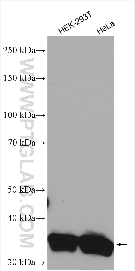 Western Blot (WB) analysis of various lysates using ARPC1B Polyclonal antibody (28368-1-AP)