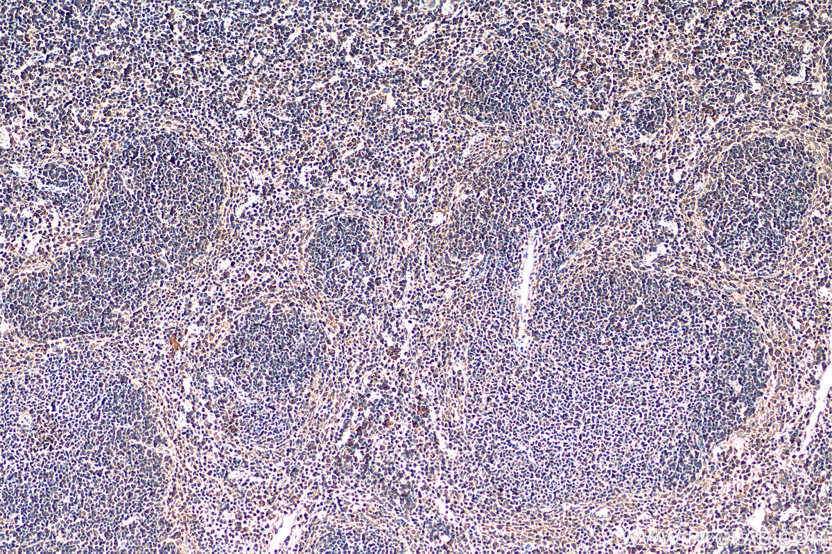 Immunohistochemistry (IHC) staining of mouse spleen tissue using ARPC1B Monoclonal antibody (67320-1-Ig)