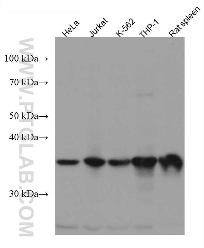 Western Blot (WB) analysis of various lysates using ARPC1B Monoclonal antibody (67320-1-Ig)