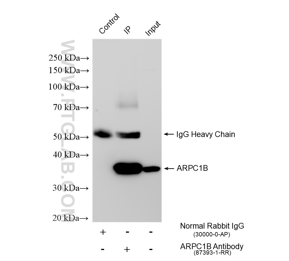 Immunoprecipitation (IP) experiment of HeLa cells using ARPC1B Recombinant monoclonal antibody (87393-1-RR)