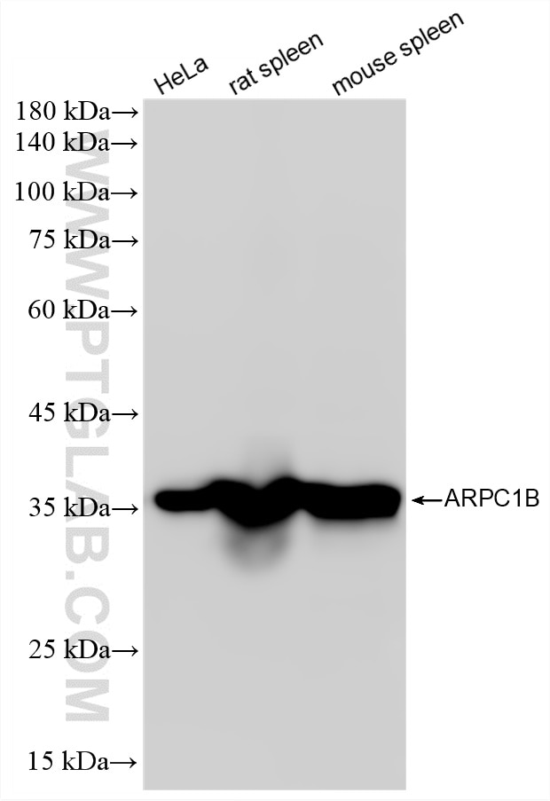 Western Blot (WB) analysis of various lysates using ARPC1B Recombinant monoclonal antibody (87393-1-RR)