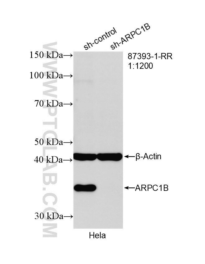 Western Blot (WB) analysis of HeLa cells using ARPC1B Recombinant monoclonal antibody (87393-1-RR)
