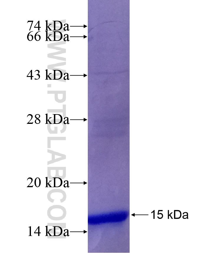 ARPC1B fusion protein Ag29095 SDS-PAGE