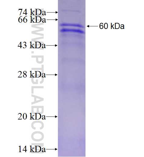 ARPC1B fusion protein Ag0995 SDS-PAGE