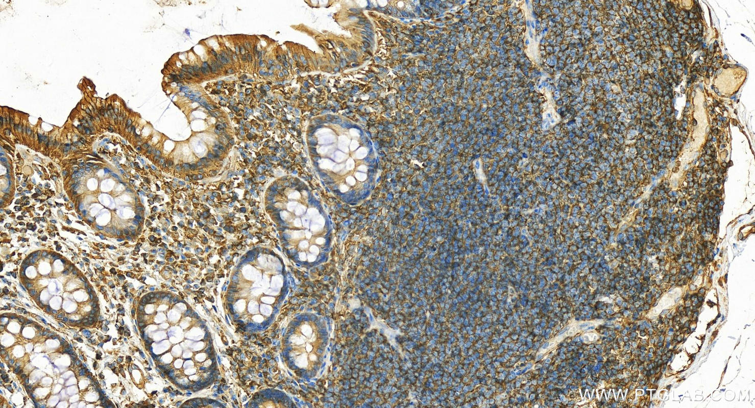 Immunohistochemistry (IHC) staining of human normal colon using ARPC2 Polyclonal antibody (15058-1-AP)