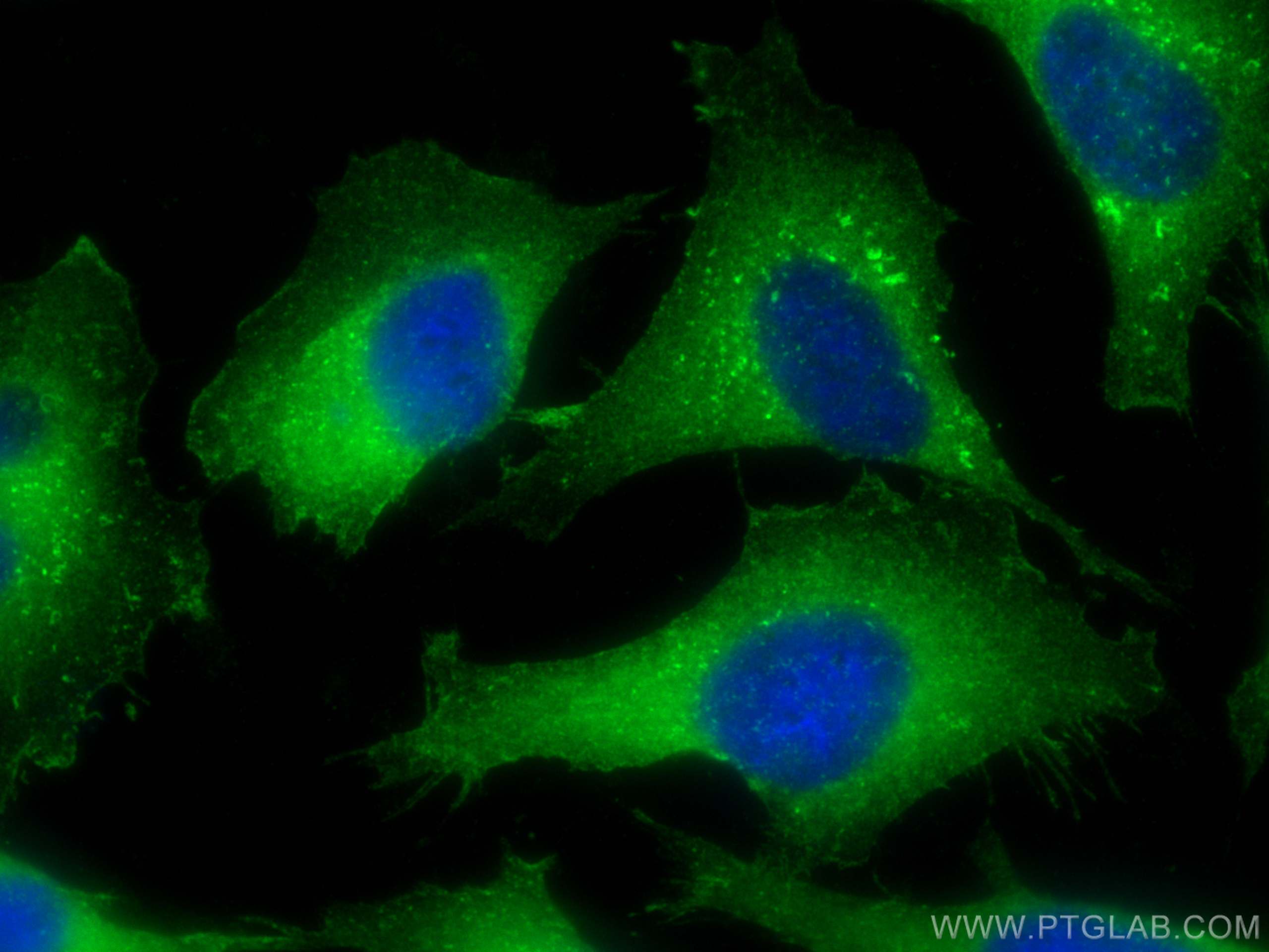 Immunofluorescence (IF) / fluorescent staining of HeLa cells using ARPC2 Polyclonal antibody (15058-1-AP)