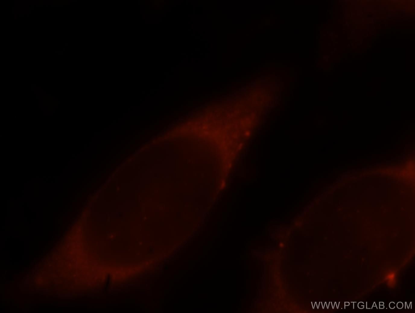 Immunofluorescence (IF) / fluorescent staining of HeLa cells using ARPC2 Polyclonal antibody (15058-1-AP)