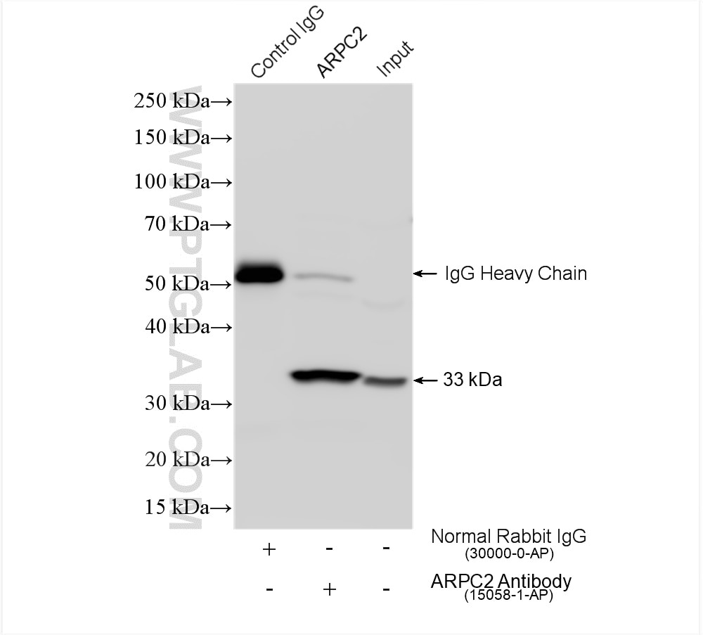 Immunoprecipitation (IP) experiment of HeLa cells using ARPC2 Polyclonal antibody (15058-1-AP)