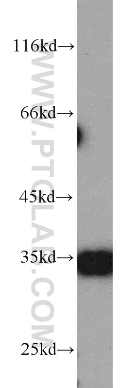 Western Blot (WB) analysis of HeLa cells using ARPC2 Polyclonal antibody (15058-1-AP)