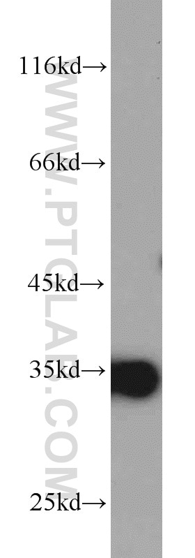 Western Blot (WB) analysis of HeLa cells using ARPC2 Polyclonal antibody (15058-1-AP)