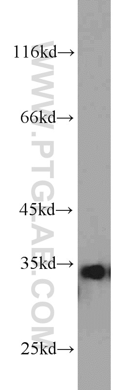 Western Blot (WB) analysis of mouse skeletal muscle tissue using ARPC2 Polyclonal antibody (15058-1-AP)