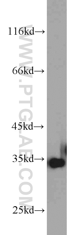 Western Blot (WB) analysis of mouse skeletal muscle tissue using ARPC2 Polyclonal antibody (15058-1-AP)