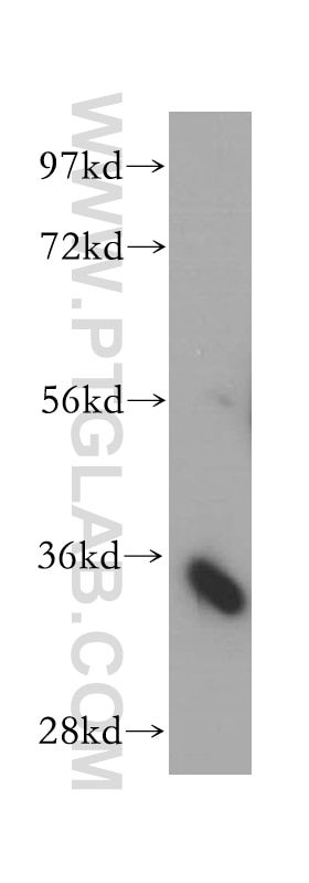 Western Blot (WB) analysis of HeLa cells using ARPC2 Polyclonal antibody (15058-1-AP)