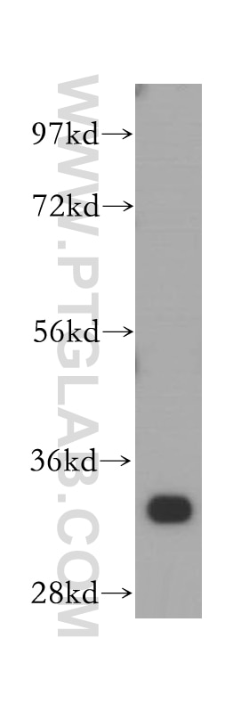 Western Blot (WB) analysis of MCF-7 cells using ARPC2 Polyclonal antibody (15058-1-AP)