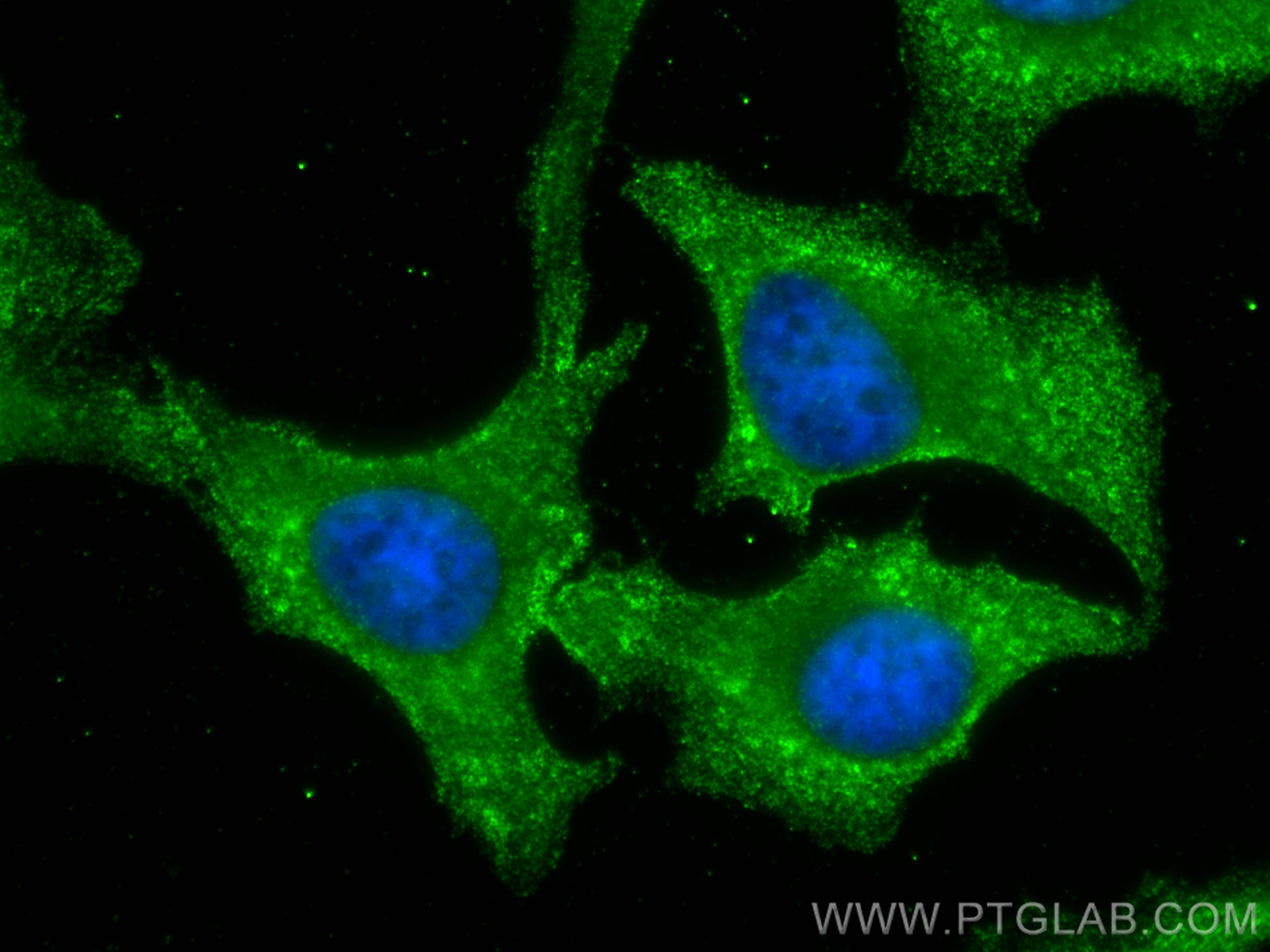 Immunofluorescence (IF) / fluorescent staining of HeLa cells using ARPC2 Monoclonal antibody (68145-1-Ig)