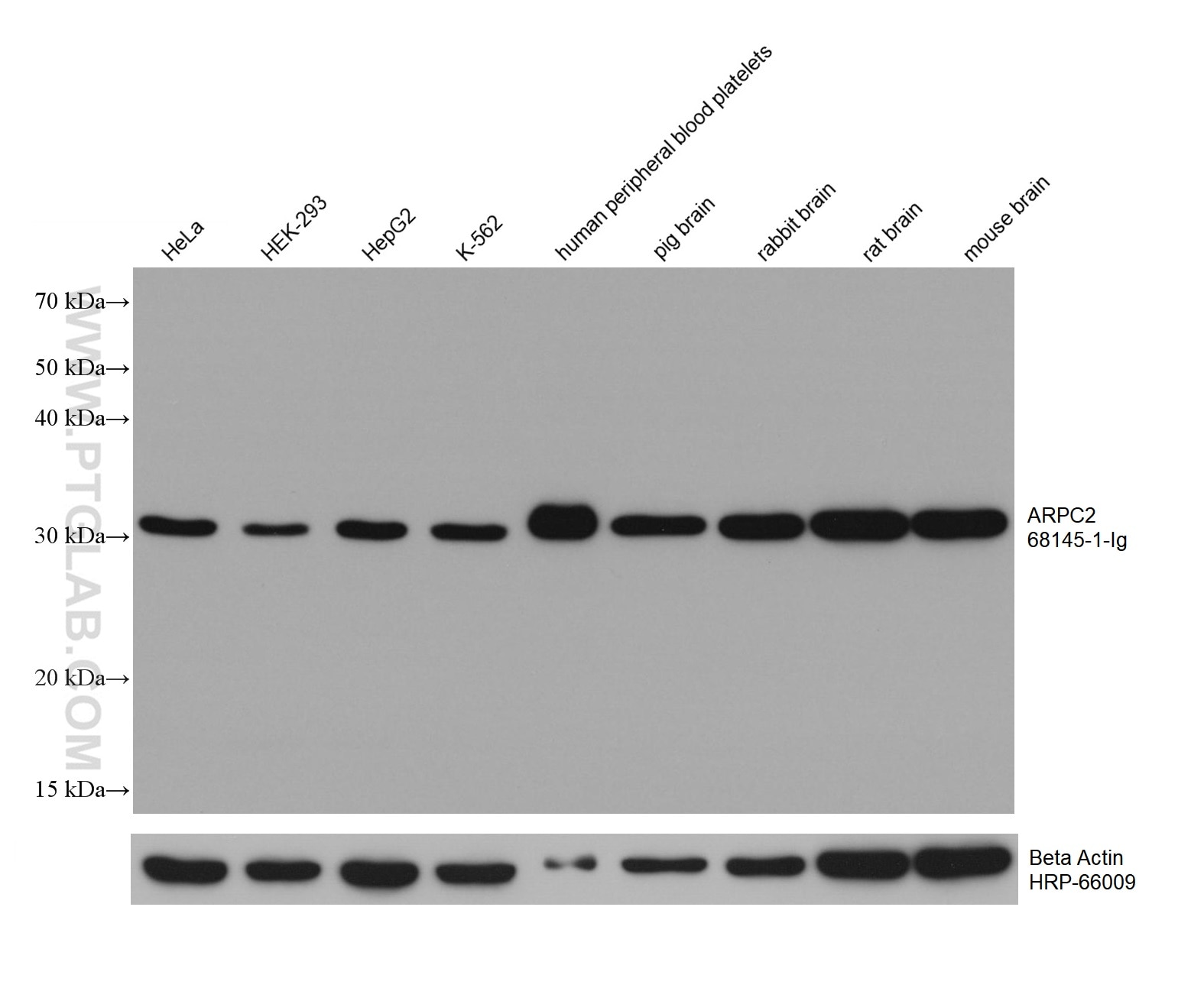 Western Blot (WB) analysis of various lysates using ARPC2 Monoclonal antibody (68145-1-Ig)