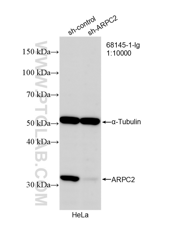 Western Blot (WB) analysis of HeLa cells using ARPC2 Monoclonal antibody (68145-1-Ig)