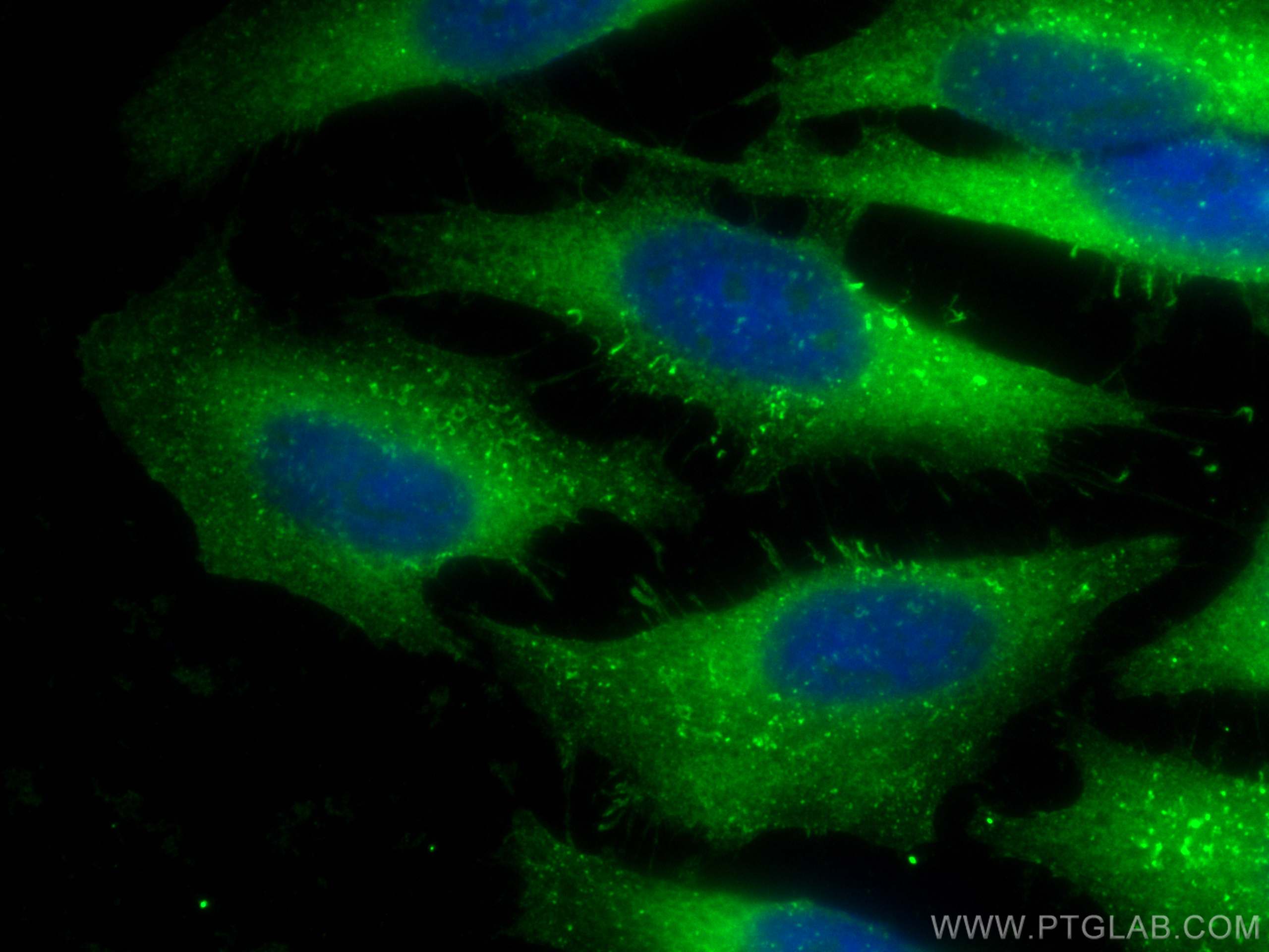 Immunofluorescence (IF) / fluorescent staining of HeLa cells using CoraLite® Plus 488-conjugated ARPC2 Polyclonal ant (CL488-15058)