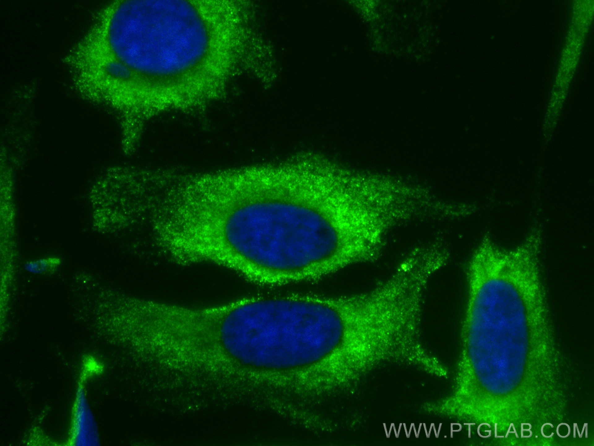 Immunofluorescence (IF) / fluorescent staining of HeLa cells using CoraLite® Plus 488-conjugated ARPC2 Monoclonal ant (CL488-68145)