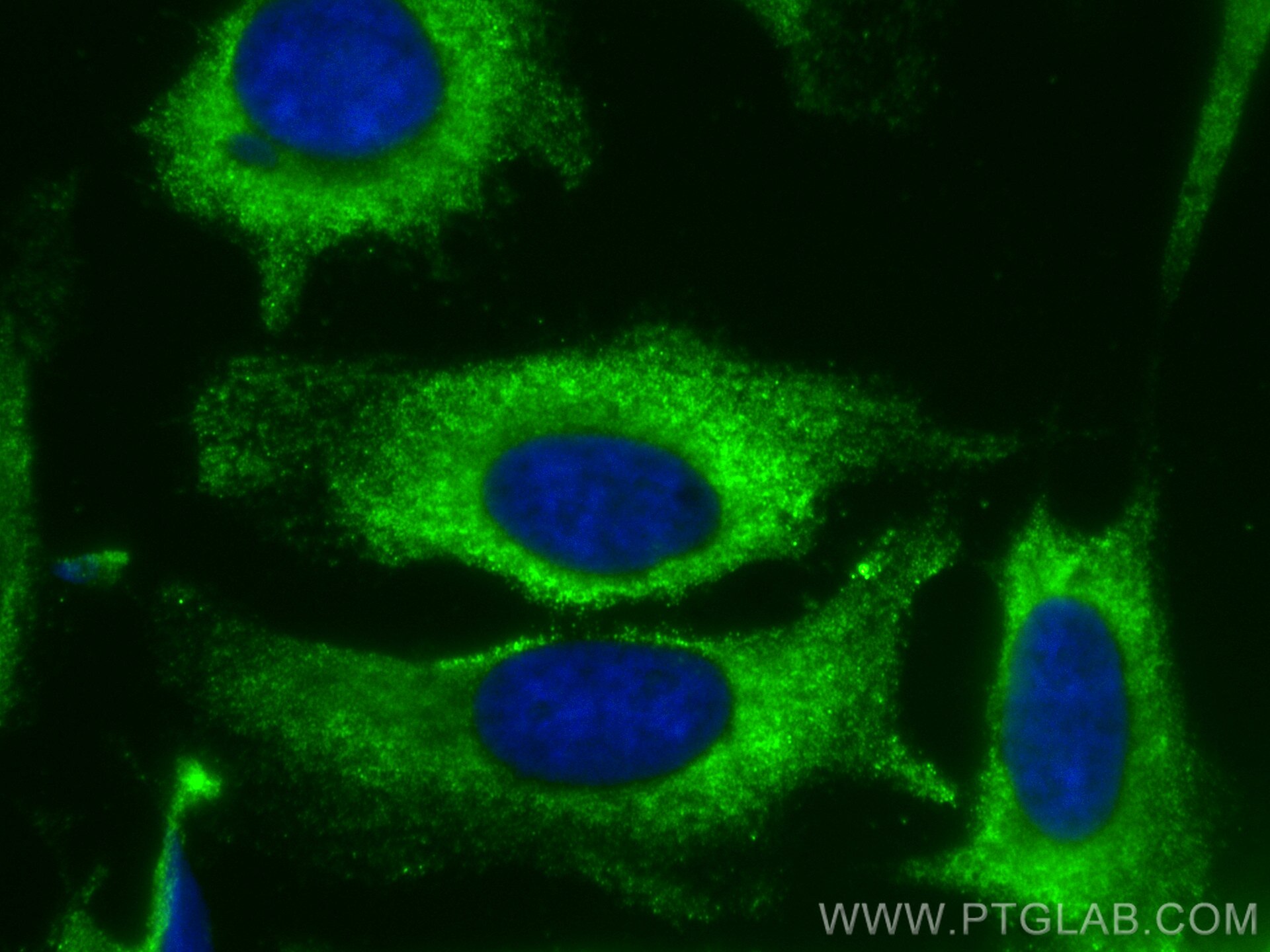 IF Staining of HeLa using CL488-68145