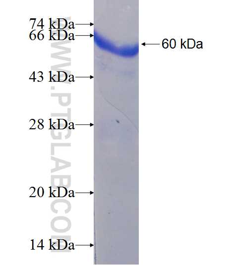 ARPC2 fusion protein Ag7041 SDS-PAGE