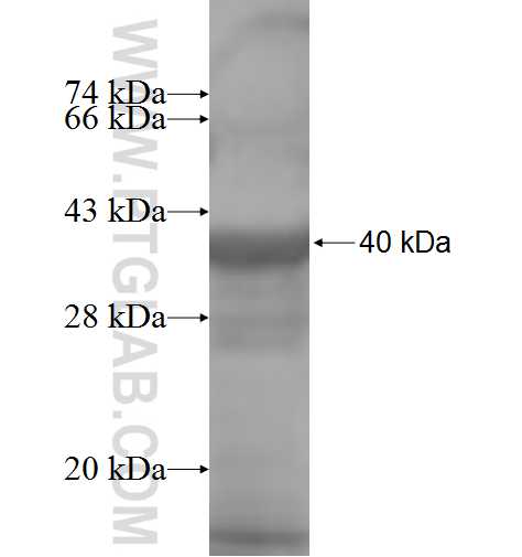 ARPC2 fusion protein Ag7082 SDS-PAGE