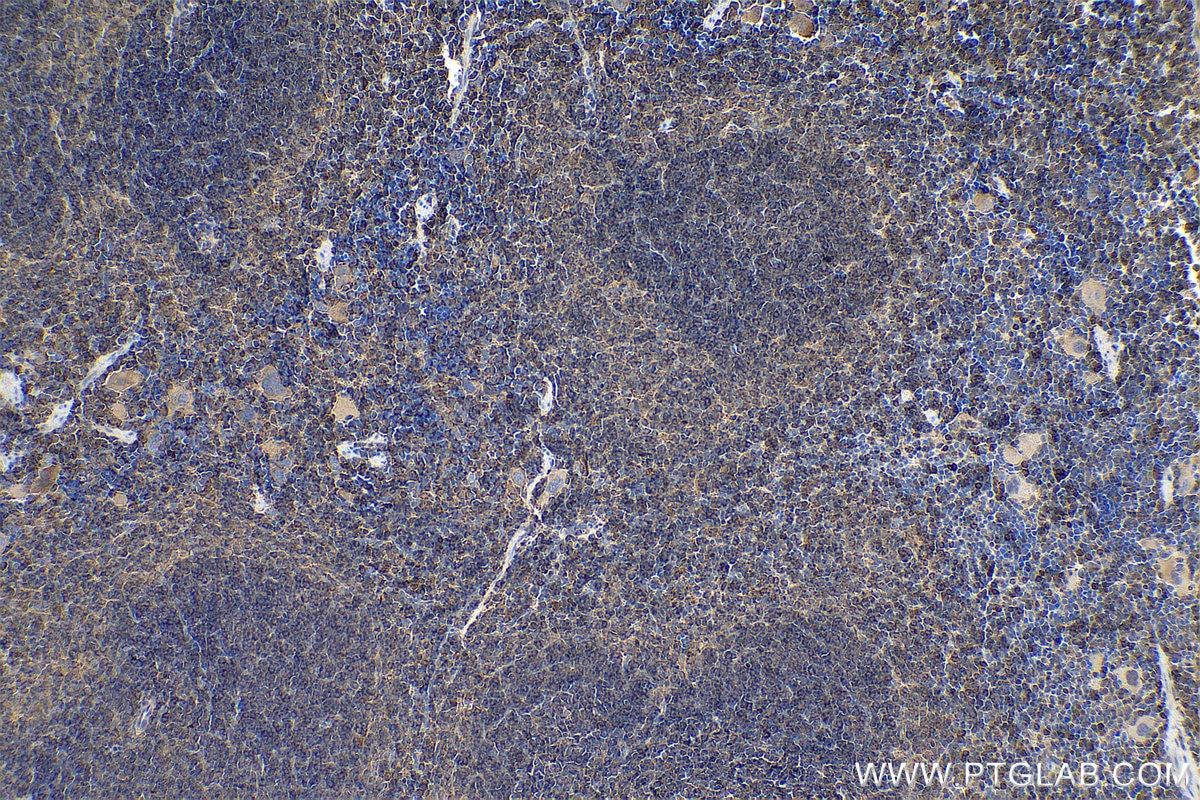 Immunohistochemistry (IHC) staining of mouse spleen tissue using ARPC3 Polyclonal antibody (14652-1-AP)