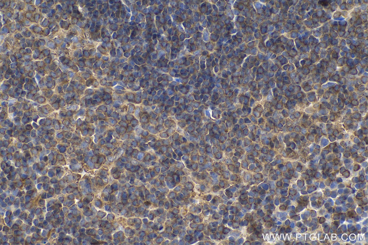 Immunohistochemistry (IHC) staining of mouse spleen tissue using ARPC3 Polyclonal antibody (14652-1-AP)