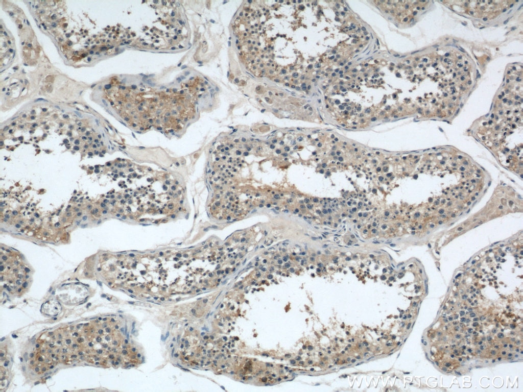 Immunohistochemistry (IHC) staining of human testis tissue using ARPC4 Polyclonal antibody (10930-1-AP)