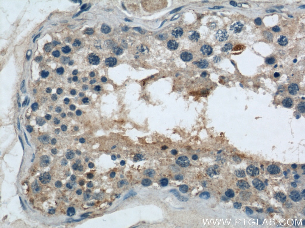 Immunohistochemistry (IHC) staining of human testis tissue using ARPC4 Polyclonal antibody (10930-1-AP)