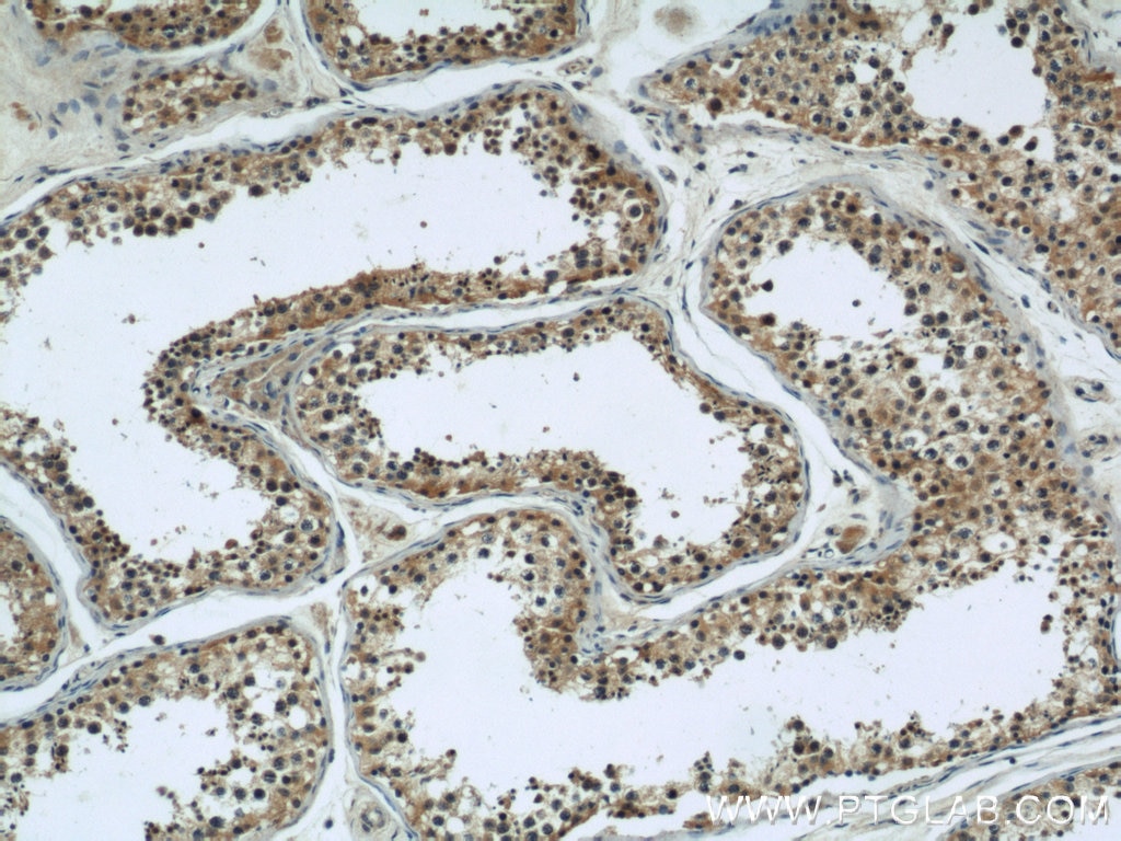 Immunohistochemistry (IHC) staining of human testis tissue using ARPC4 Polyclonal antibody (10930-1-AP)