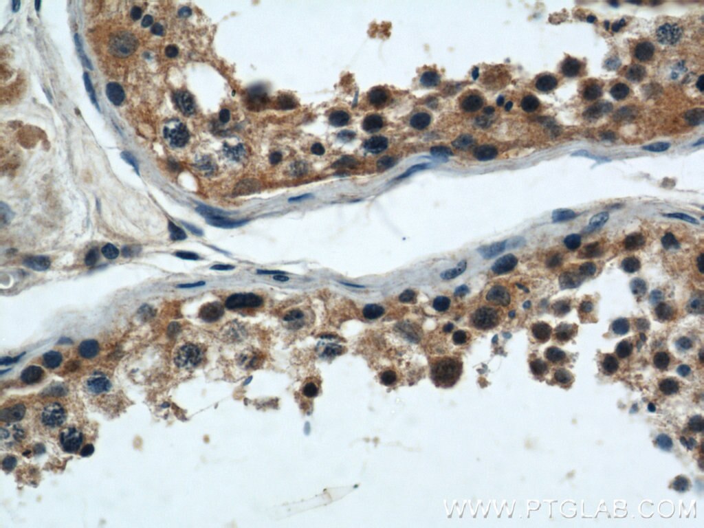 Immunohistochemistry (IHC) staining of human testis tissue using ARPC4 Polyclonal antibody (10930-1-AP)