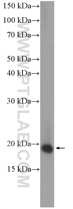Western Blot (WB) analysis of MCF-7 cells using ARPC4 Polyclonal antibody (10930-1-AP)