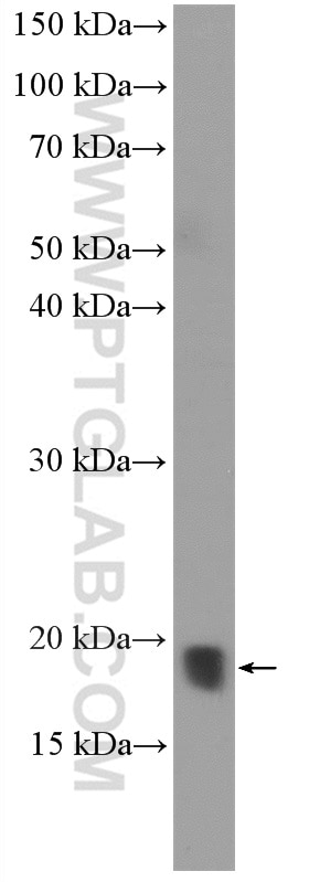 Western Blot (WB) analysis of 4T1 cells using ARPC4 Polyclonal antibody (10930-1-AP)