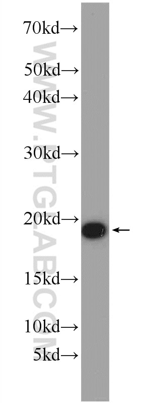 Western Blot (WB) analysis of mouse brain tissue using ARPC4 Polyclonal antibody (10930-1-AP)