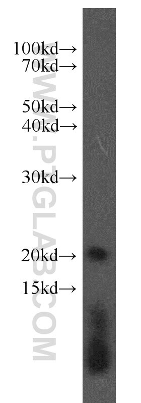 Western Blot (WB) analysis of human brain tissue using ARPC4 Polyclonal antibody (10930-1-AP)