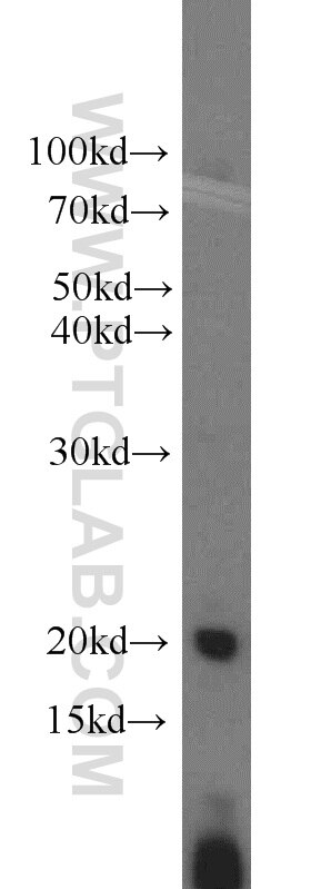 Western Blot (WB) analysis of human placenta tissue using ARPC4 Polyclonal antibody (10930-1-AP)