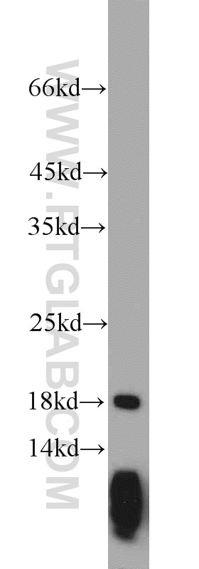 Western Blot (WB) analysis of mouse small intestine tissue using ARPC4 Polyclonal antibody (10930-1-AP)