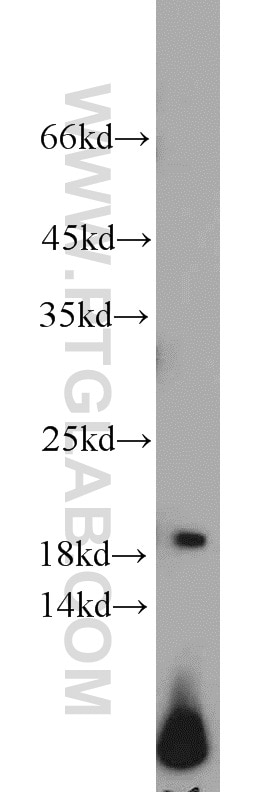 Western Blot (WB) analysis of rat lymph tissue using ARPC4 Polyclonal antibody (10930-1-AP)