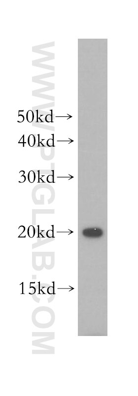 Western Blot (WB) analysis of human brain tissue using ARPC4 Polyclonal antibody (10930-1-AP)