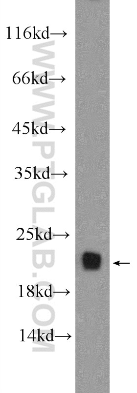 Western Blot (WB) analysis of mouse brain tissue using ARPC5 Polyclonal antibody (16717-1-AP)